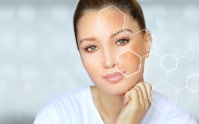 Cómo prevenir las manchas solares en tu piel