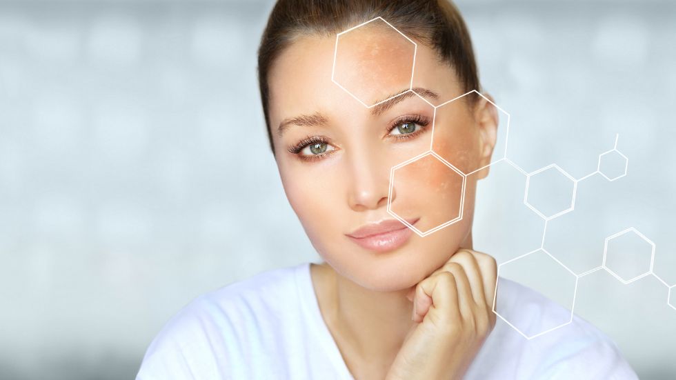 prevenir manchas solares